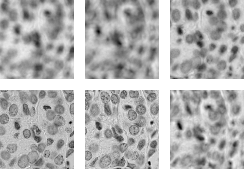 Focus-challenge on scanned microscopy images. #DoMore!, @icgi.no