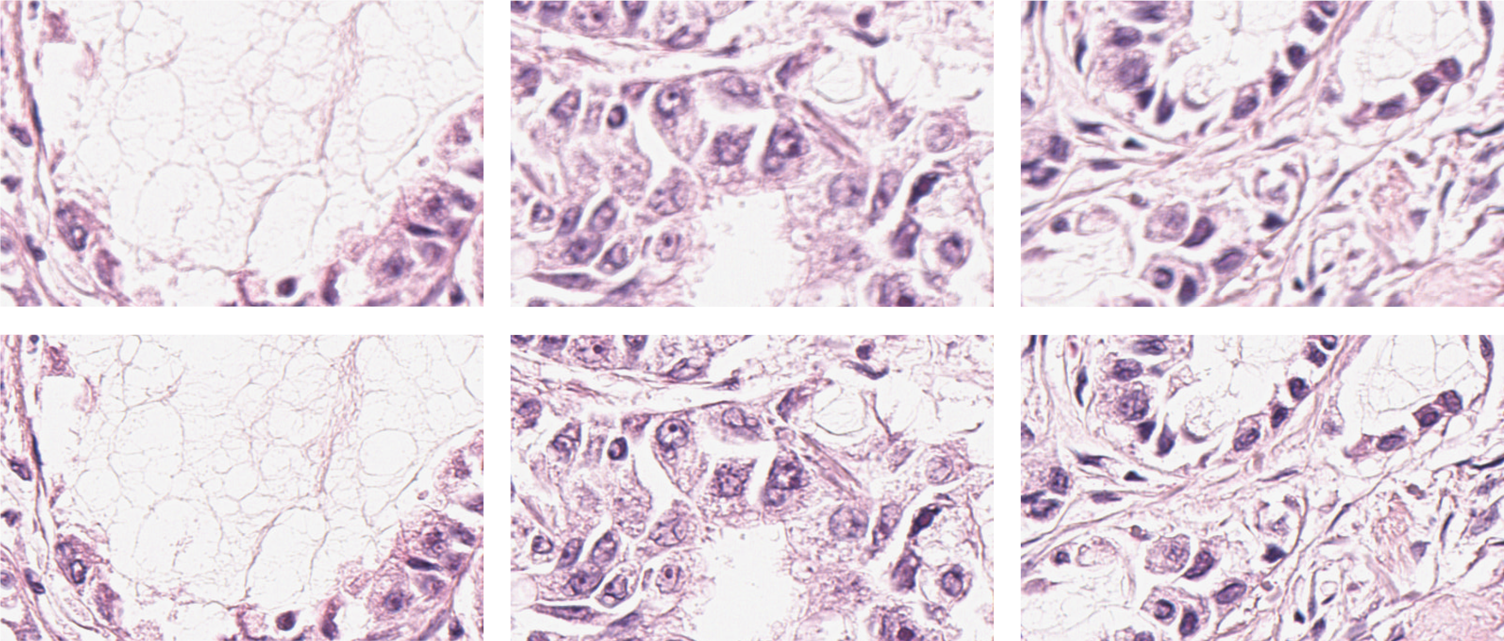 Focus-challenge on HE-stained scanned microscopy images. #DoMore!, @icgi.no